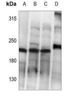 Anti-Collagen 5 alpha 1 Antibody