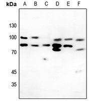 Collagen VI antibody