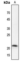 Anti-Claudin 4 Antibody