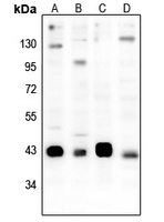 Anti-CREB (Phospho-S133) Antibody