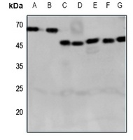 Anti-CRHR2 Antibody