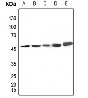 Anti-CK1 delta Antibody