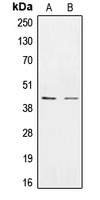 Anti-CK1 epsilon Antibody