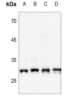 CSNK2B (phospho-S209) antibody