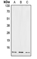 Anti-Cystatin B Antibody