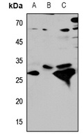 CTSD antibody