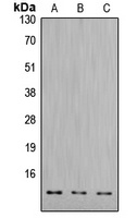 Anti-Cathepsin D LC Antibody