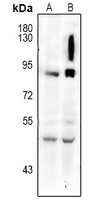 Anti-gp91 phox Antibody