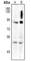 CYBB antibody