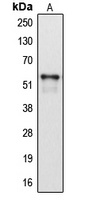 Anti-Cytochrome P450 2A6 Antibody