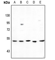 Anti-Cytochrome P450 2D6 Antibody