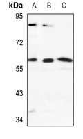 CYP2J2 antibody
