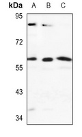 Anti-Cytochrome P450 2J2 Antibody