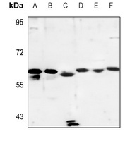 Anti-Cytochrome P450 4A11/22 Antibody