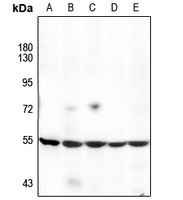 Anti-Cytochrome P450 17A1 Antibody