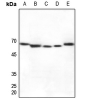 CYP27A1 antibody