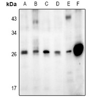 Anti-GADD153 Antibody