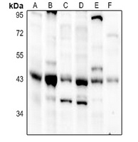 Anti-DHPS Antibody