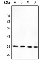 CYB5R3 antibody