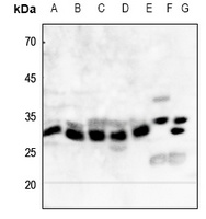 Anti-NQO1 Antibody