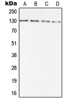 Anti-DIAPH2 Antibody