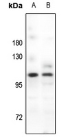 Anti-PSD93 Antibody