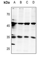 E2F6 antibody