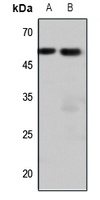 Anti-Endothelin A Receptor Antibody