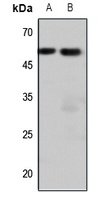 Endothelin 1 antibody