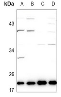 Anti-Ephrin A1 Antibody