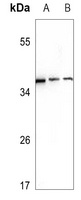 Anti-Ephrin A3 Antibody
