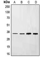 Anti-Ephrin B3 Antibody