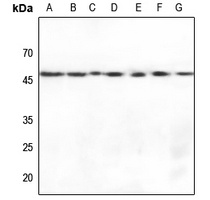 Anti-Gamma-enolase Antibody