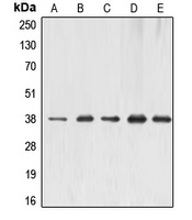 Anti-ERCC1 Antibody