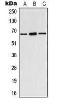 Estrogen R alpha (phospho-Y537) antibody