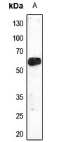 Anti-TEL Antibody