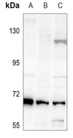 Anti-Factor XII HC Antibody