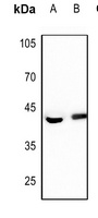 FEN1 antibody