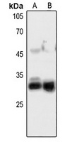 Anti-FGF5 Antibody