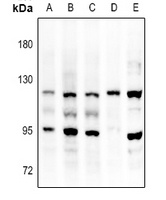 FGFR3 antibody