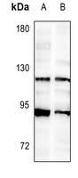 FGFR2 antibody