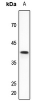 Anti-VEGFD Antibody