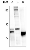 Anti-FOXO1 (Phospho-S319) Antibody