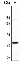 Anti-FSHR Antibody