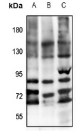 Anti-FSHR Antibody
