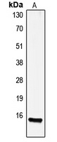 Anti-Gastrin Antibody