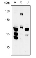 FYB antibody