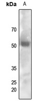 Anti-FYN (Phospho-Y530) Antibody