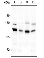 Anti-GABBR1 Antibody