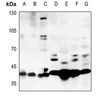 Anti-GATA1 Antibody